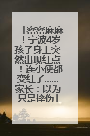 密密麻麻！宁波4岁孩子身上突然出现红点！连小便都变红了……家长：以为只是摔伤